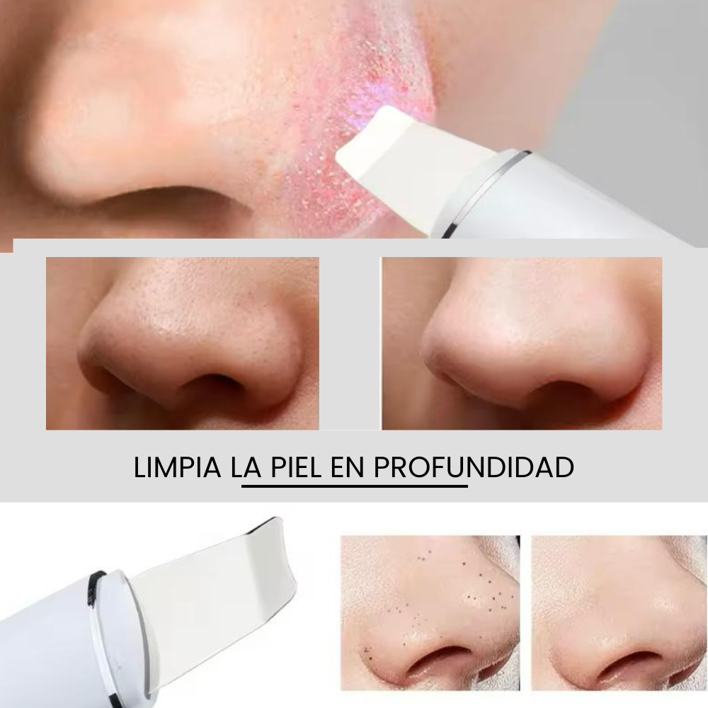 Peeling ultrasónico portátil de piel sónica